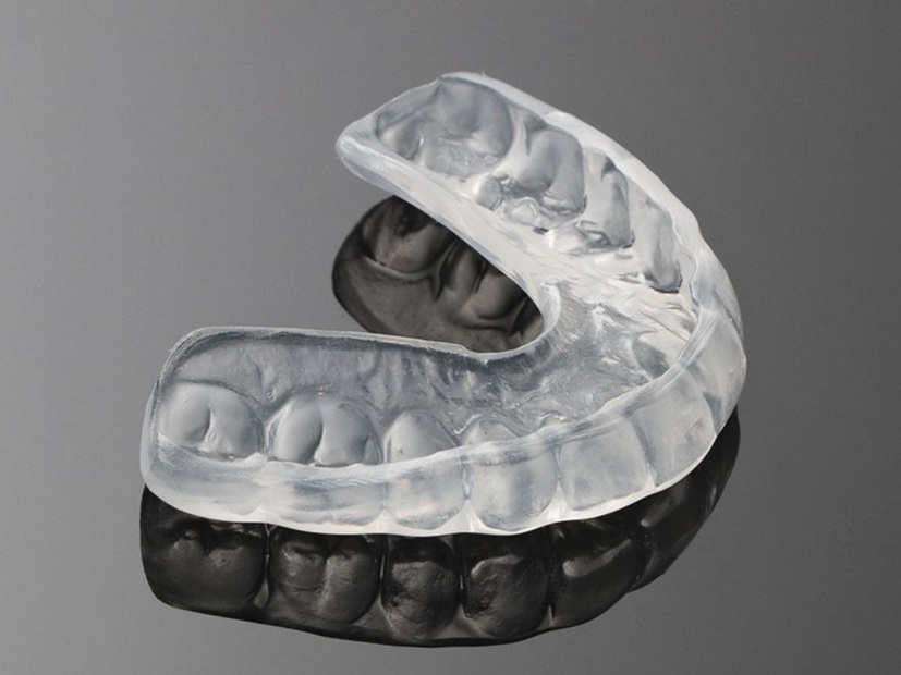 custom fitted mouthguard