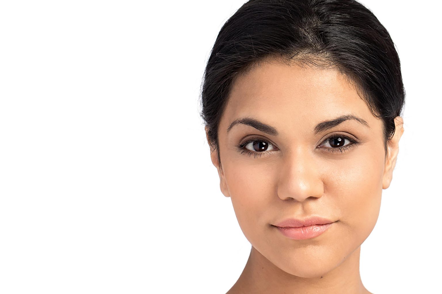 dermal fillers in South Miami