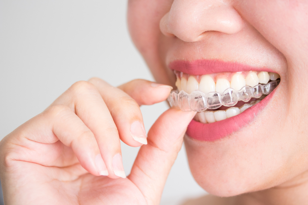 say goodbye to dry mouth refreshing remedies for invisalign users