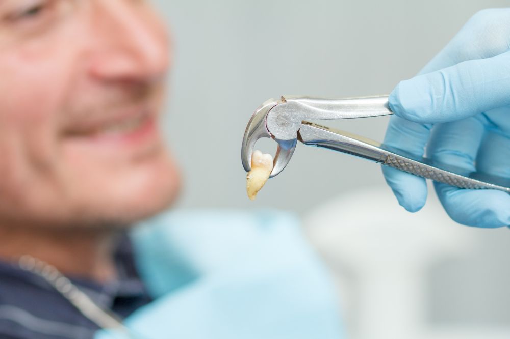 damaged tooth following a dental injury